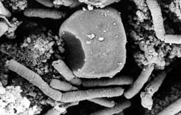 Il batterio del carbonchio.